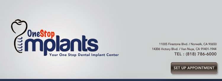 One Stop Implants | 11005 Firestone Blvd, Norwalk, CA 90650, USA | Phone: (562) 863-8888