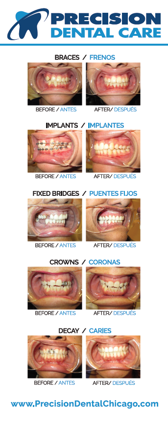 Precision Dental Care | 4317 S Ashland Ave, Chicago, IL 60609, USA | Phone: (773) 579-0422