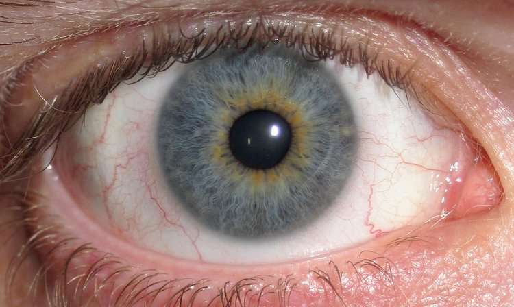 What is Iridology - InSpiral | 40 Estabrook Rd, Carlisle, MA 01741 | Phone: (617) 637-6672