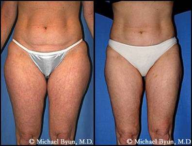 Chicago Cosmetic Surgery: Michael Byun M.D. | 1775 Walters Ave, Northbrook, IL 60062, USA | Phone: (847) 513-6899