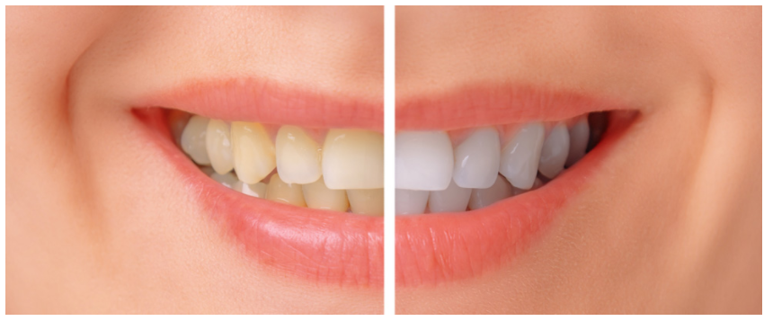 Mundelein Dental Center | 333 IL-83, Mundelein, IL 60060 | Phone: (847) 566-7212