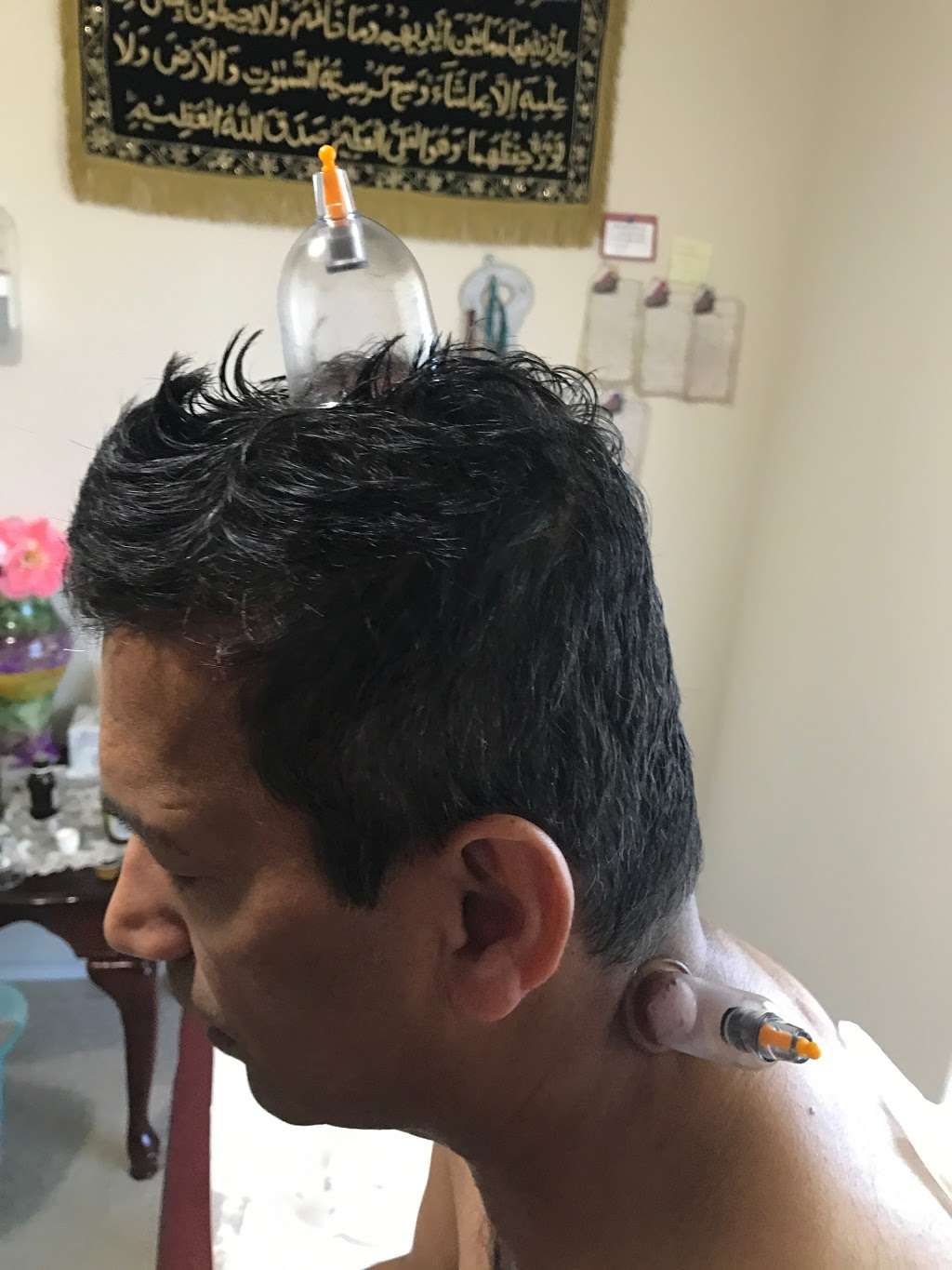 SHAAFI HIJAMA CUPPING CENTER | 4213 Birch Colony Ct, Porter, TX 77365, USA | Phone: (281) 508-4249