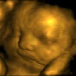 Bella Baby 4D Ultrasound of Houston | 3411 Cedar Knolls Dr, Kingwood, TX 77339, USA | Phone: (281) 407-0470