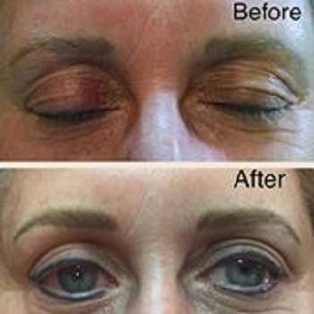 All About You Permanent Makeup | 94 Hidlay Church Rd, Bloomsburg, PA 17815, USA | Phone: (570) 387-1990