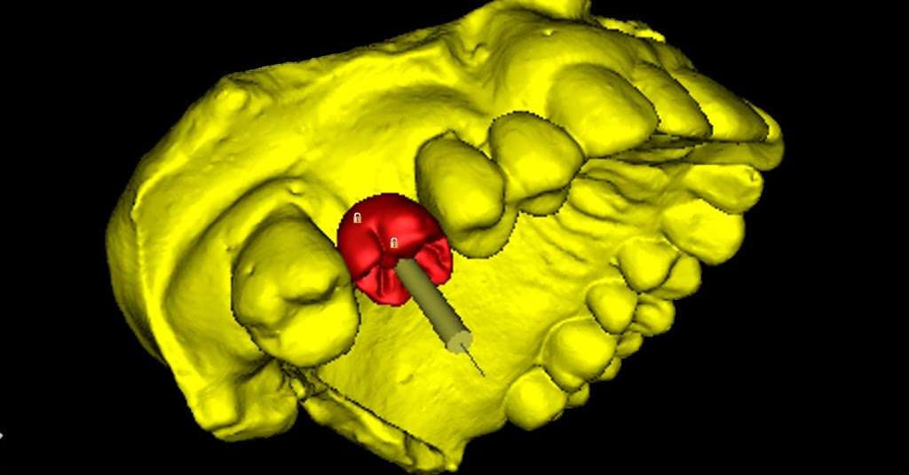 TDL Dental Group | 2933 Webster St, Oakland, CA 94609, USA | Phone: (510) 451-2058