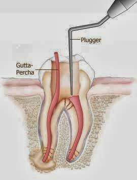 Root Vision Endo | 1110 N Brand Blvd, Glendale, CA 91202, USA | Phone: (818) 242-4770