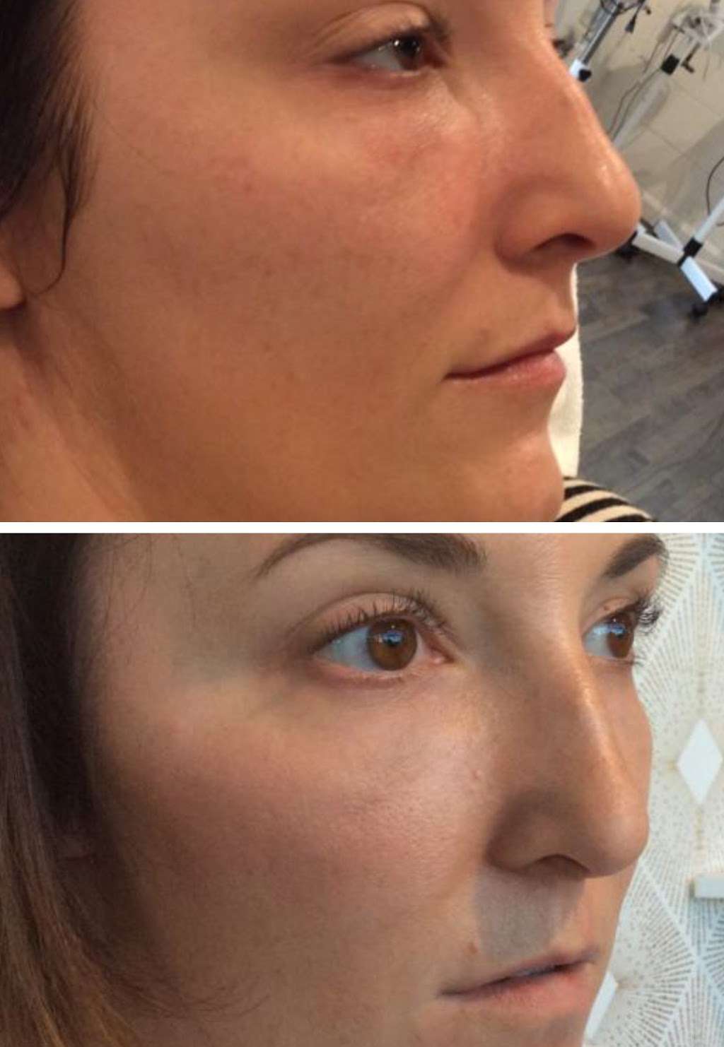 Esthetics by Rachel at Alchemy Face Bar Highlands | 4343 W 44th Ave, Denver, CO 80212 | Phone: (720) 441-2101