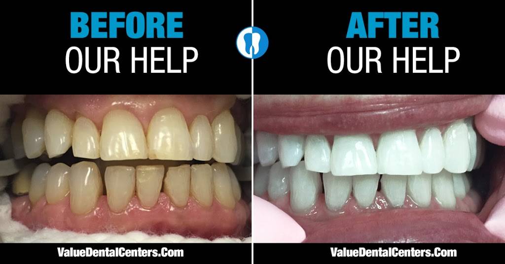 Value Dental Centers | 1955 S Stapley Dr, Mesa, AZ 85204, USA | Phone: (480) 418-2667