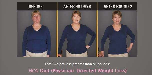 Chicago Weight Loss | 1321 Tower Rd Unit A, Schaumburg, IL 60173 | Phone: (847) 995-9000