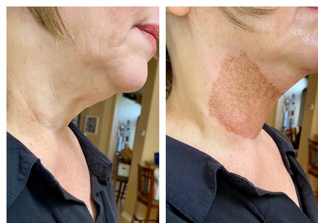 Uplift Skin Refinery | Orlando Skin Tightening | Nonsurgical Pla | 900 Fox Valley Dr Suite #100, Longwood, FL 32779, USA | Phone: (407) 564-6624