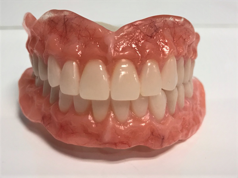 Carolina Dentures | 1010 Mooresville Rd, Salisbury, NC 28147 | Phone: (704) 754-8535