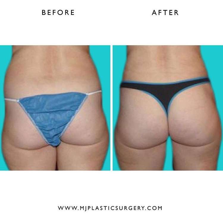 Jaibaji Plastic Surgery | 1001 B Ave Suite 108, Coronado, CA 92118, USA | Phone: (619) 435-1736