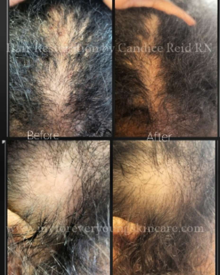 Forever Young Skin Care | 7600 Stenton Ave #1k, Philadelphia, PA 19118, USA | Phone: (267) 415-6556