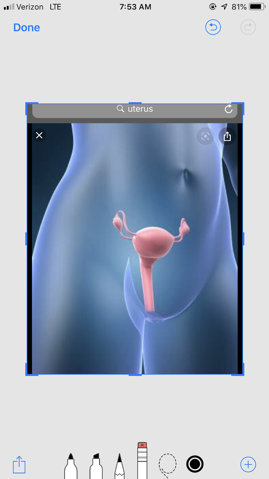 Women’s NY abortion center | 6721 Avenue U, Brooklyn, NY 11234, USA | Phone: (718) 531-6969