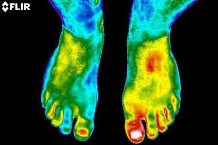 Thermography of Crosby | 118 Kernohan St, Crosby, TX 77532, USA | Phone: (281) 886-8801