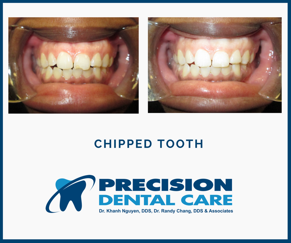 Precision Dental Care | 5745 W Belmont Ave, Chicago, IL 60634, USA | Phone: (773) 622-2642