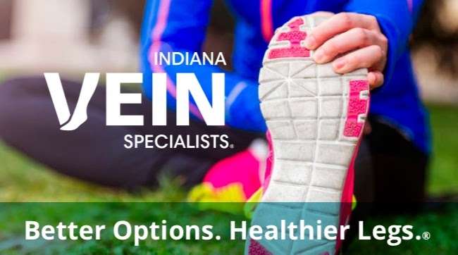 Indiana Vein Specialists | 11876 Olio Rd #700, Fishers, IN 46037 | Phone: (317) 348-3023