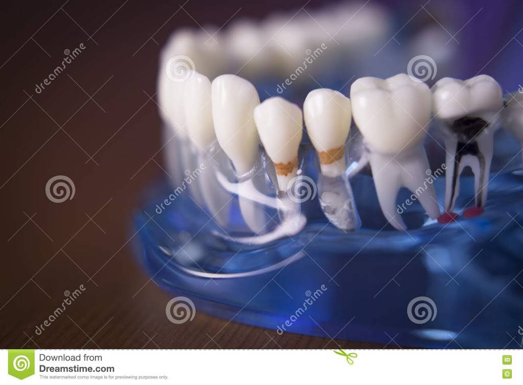 Tracy Dental Center | 1866 W 11th St, Tracy, CA 95376, USA | Phone: (209) 833-9322