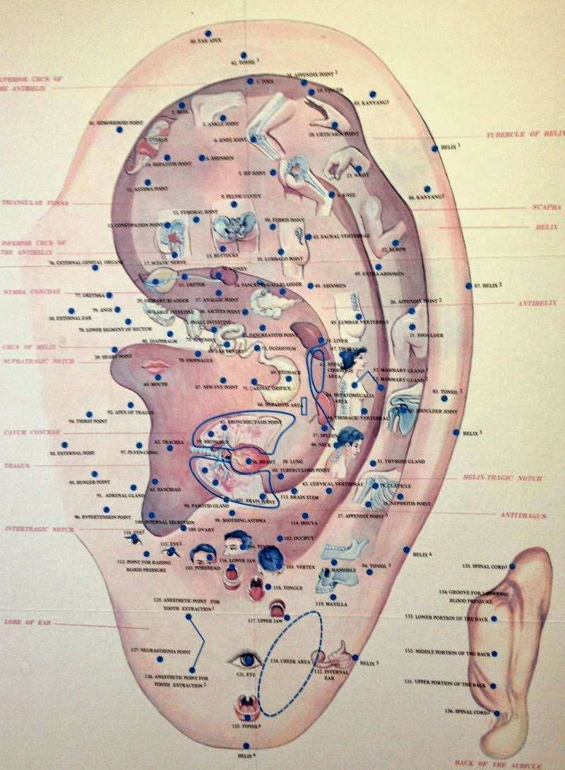 EFFECTIVE ACUPUNCTURE | 8249 Zephyr St, Arvada, CO 80005 | Phone: (303) 547-7451