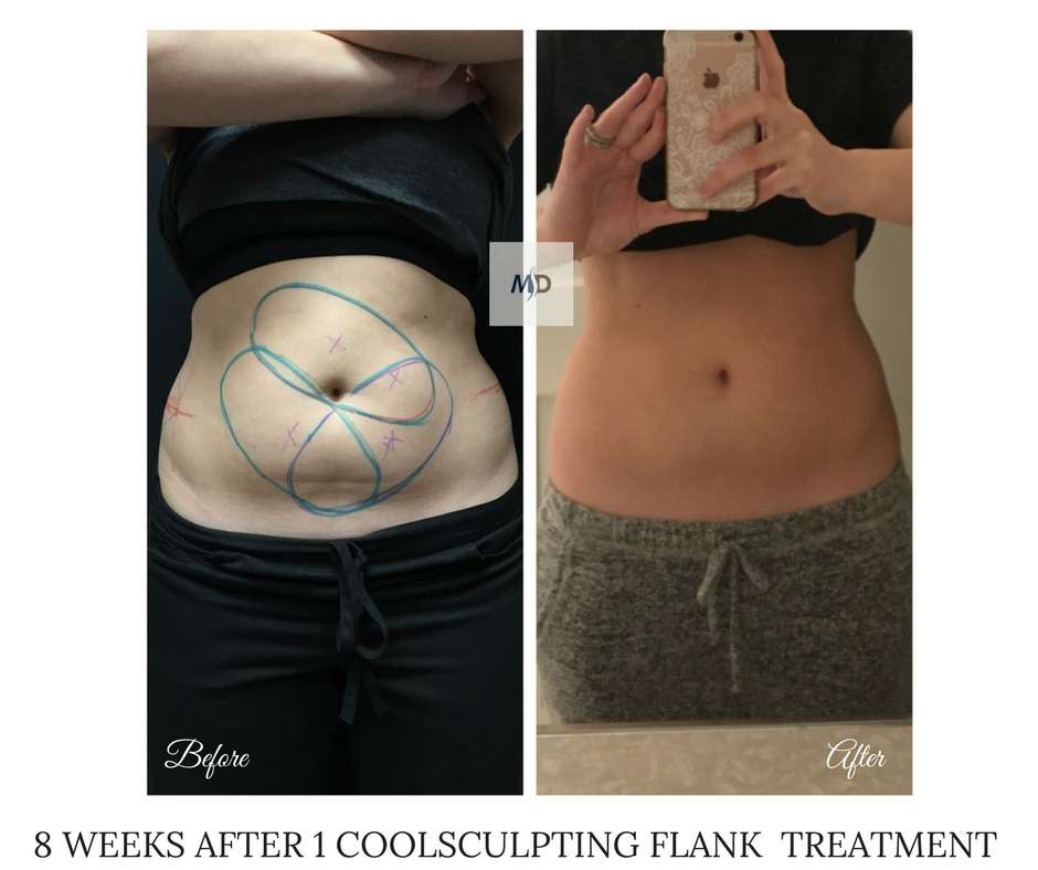 Metropolitan Dermatology - CoolSculpting Staten Island | 1324 Victory Blvd, Staten Island, NY 10301, USA | Phone: (718) 448-4488