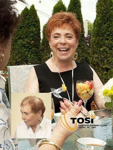 Tosis Hair Replacement Clinic | 390 Slocum Ave, Exeter, PA 18643, USA | Phone: (570) 693-3276