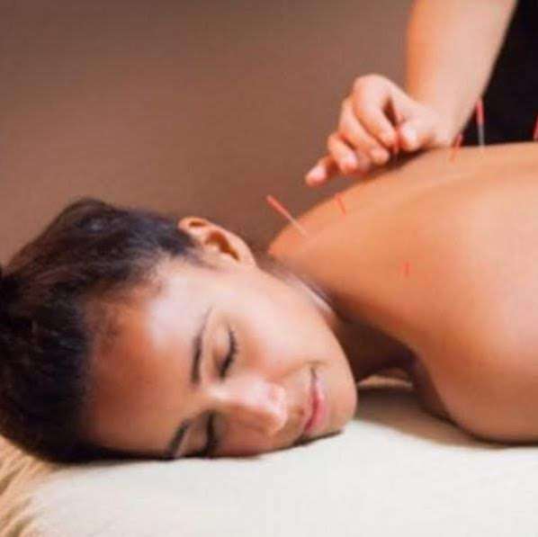 myKorWellness Acupuncture | 3701 50th St W, Rosamond, CA 93560 | Phone: (213) 984-1199