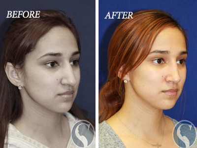 Stallworth Facial Plastic Surgery | 21 Spurs Ln #120a, San Antonio, TX 78240, USA | Phone: (210) 997-3223