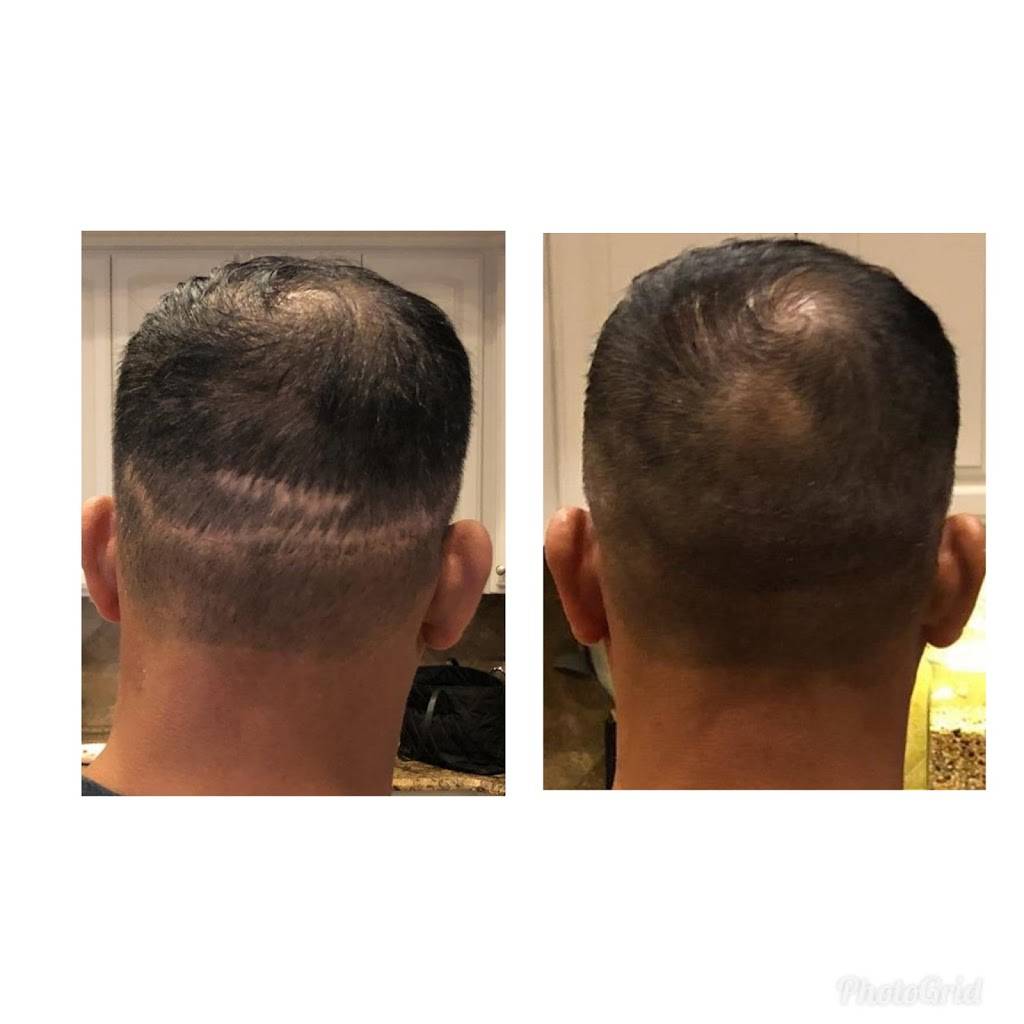 Scottsdale Hairlines Scalp MicroPigmentation Hairloss Clinic | 3295 N Drinkwater Blvd Suite 16, Scottsdale, AZ 85251, USA | Phone: (602) 680-0008