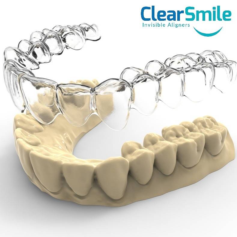 ClearSmile Miami | 5748 NE 4th Ave, Miami, FL 33137, USA | Phone: (305) 515-0600