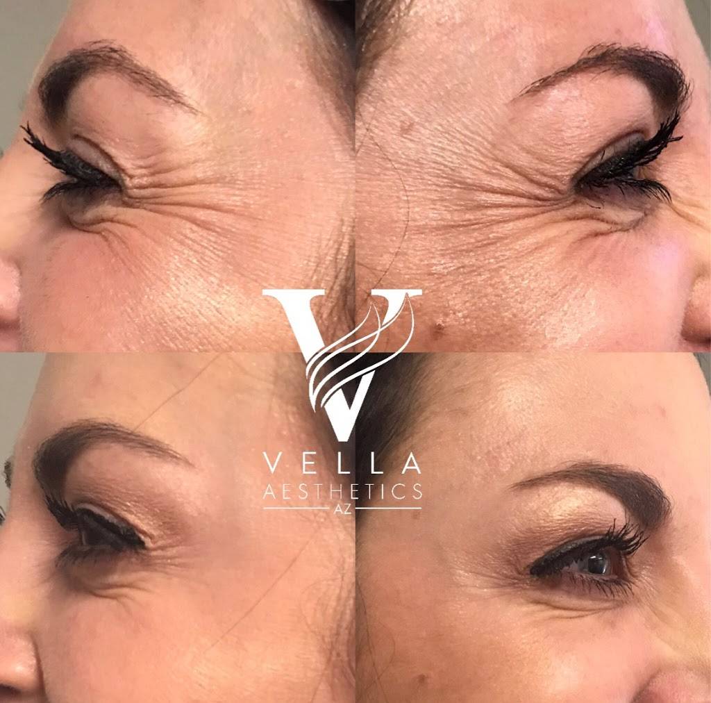 Vella Aesthetics AZ | 10265 W Camelback Rd Ste 130, Phoenix, AZ 85037 | Phone: (602) 206-0183