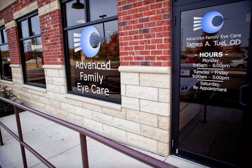 Advanced Family Eyecare | W., 24510 Lockport St, Plainfield, IL 60544, USA | Phone: (815) 254-2546