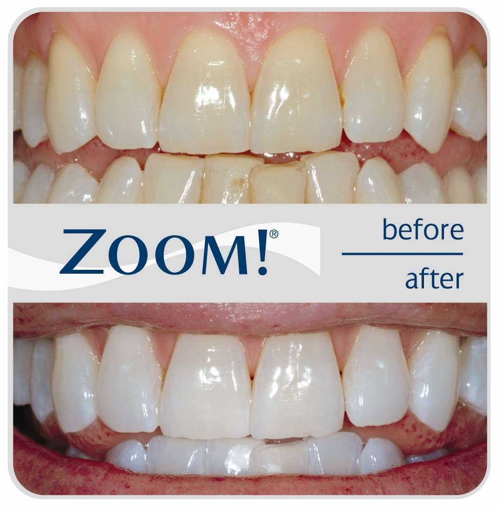 Cabo Dental | 1701 Farm to Market 1960 Rd W m, Houston, TX 77090 | Phone: (832) 446-3646