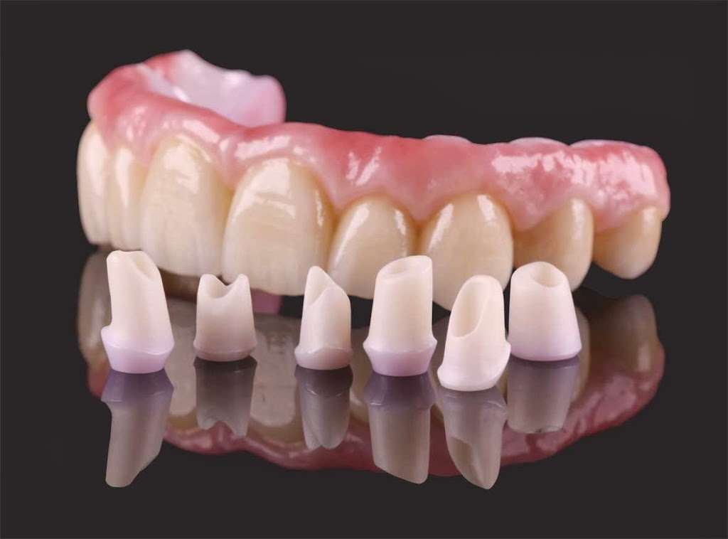 Amalia Dental Group / Dental Implants | 528 Amalia Ave, Los Angeles, CA 90022, USA | Phone: (323) 488-3366