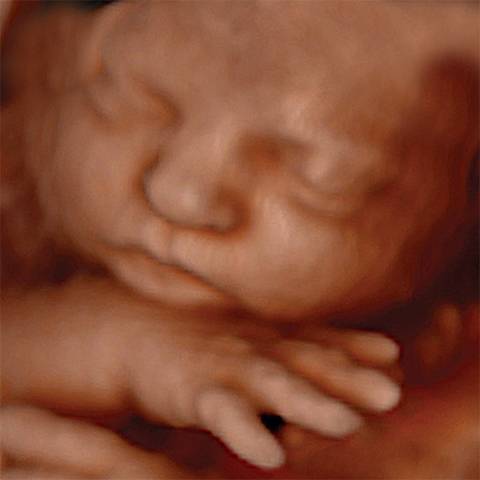 Blooming Baby 3D/4D/HD Ultrasound Studio | 4600 Greenville Ave #185, Dallas, TX 75206, USA | Phone: (214) 696-2229