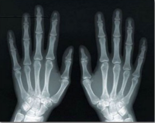 Coastal Mobile X-Ray | 405 17th St, San Diego, CA 92101, USA | Phone: (619) 324-7333