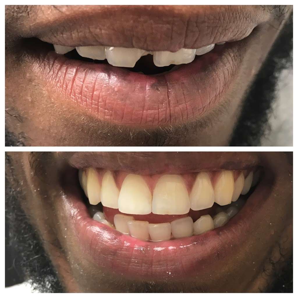 Family Dentistry 2000 | 571 N 6th St, Newark, NJ 07107, USA | Phone: (973) 485-5429