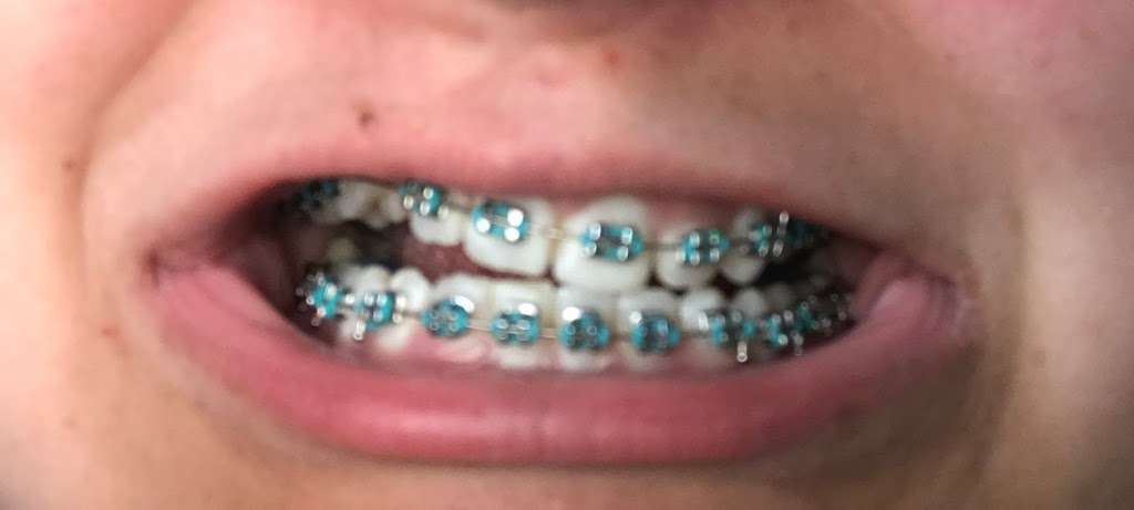 Smiley Dental & Orthodontics | 3234 Forest Ln, Dallas, TX 75234, USA | Phone: (972) 484-5400