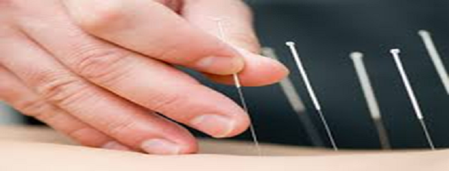 Acupuncture by Dr. Halina O’Neill | 370 Camino Gardens Blvd #113, Boca Raton, FL 33432, USA | Phone: (561) 251-6676