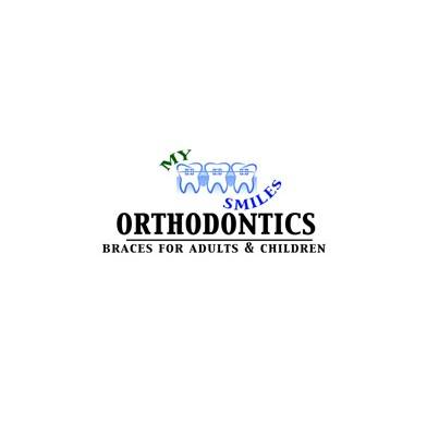 My Smiles Orthodontics of Queens | 75-05 Parsons Blvd, Flushing, NY 11366, United States | Phone: (718) 380-1230