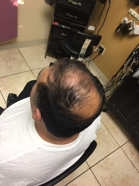 Hair Replacements by George Gordiany | 2015 NE Interstate 410 Loop, San Antonio, TX 78217, United States | Phone: (210) 788-9130