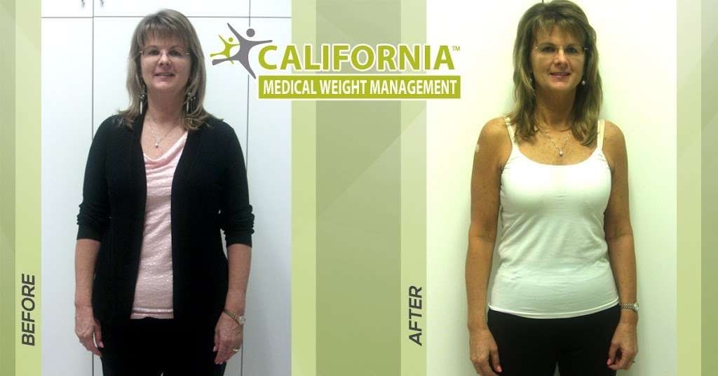 California Medical Weight Management - Scottsdale, AZ | 4845 E Thunderbird Rd, Scottsdale, AZ 85254, USA | Phone: (480) 771-0893