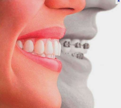 ALL COMFY DENTAL | 14649 Victory Blvd Suite # 20, Van Nuys, CA 91411, USA | Phone: (818) 387-8676