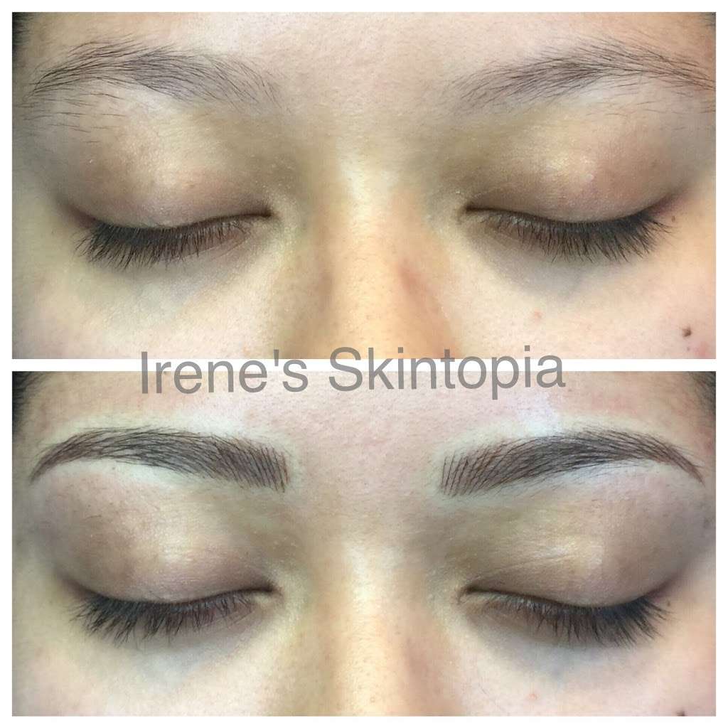 Irenes Skintopia | 3130 W Olympic Blvd #270, Los Angeles, CA 90006, USA | Phone: (213) 703-7037