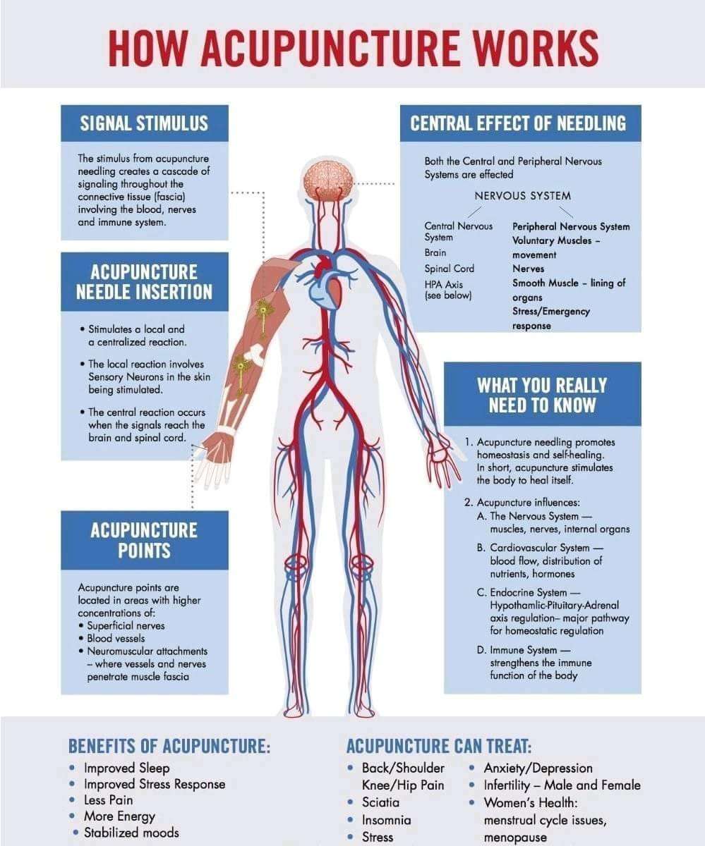 Advanced Traditional Acupuncture | 27403 Ynez Rd #214, Temecula, CA 92591, USA | Phone: (951) 308-2646