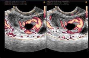 London Womens Centre - Private Gynaecology & Urogynaecology Con | The New Victoria Hospital, 184 Coombe Lane West,, Kingston upon Thames KT2 7EG, UK | Phone: 020 8949 9020