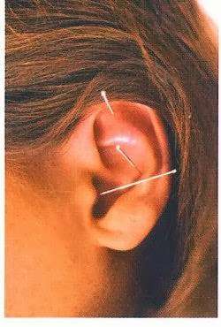 The Dragon and Phoenix Healer | 3215 Highland Ave, Manhattan Beach, CA 90266, USA | Phone: (310) 545-6528