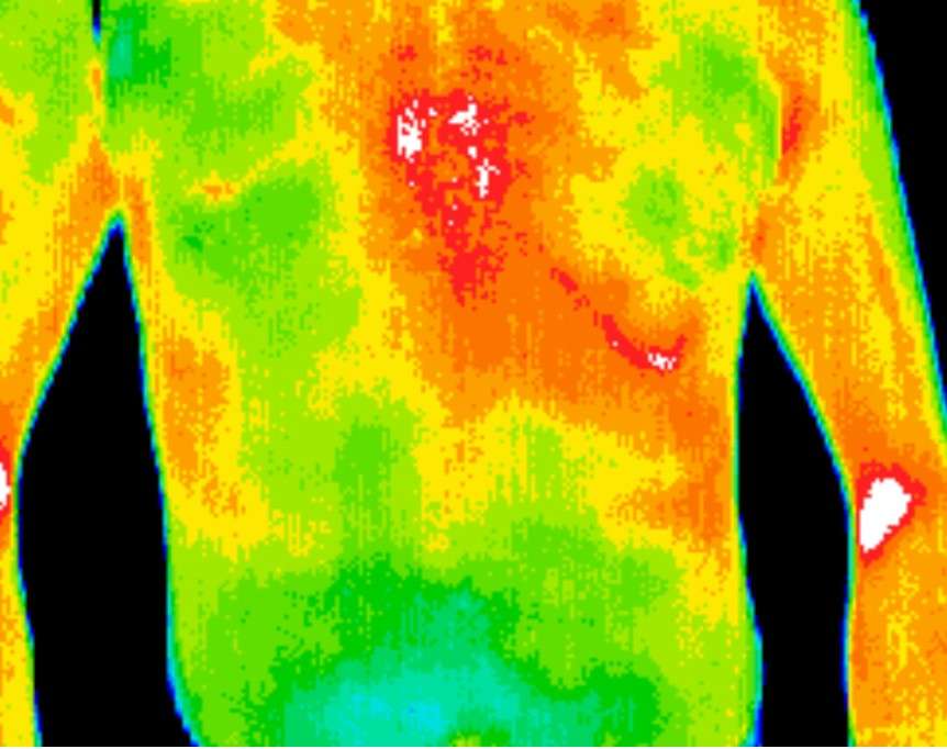 East Valley Thermography | 16815 S Desert Foothills Pkwy Suite 119, Phoenix, AZ 85048, USA | Phone: (602) 730-1644