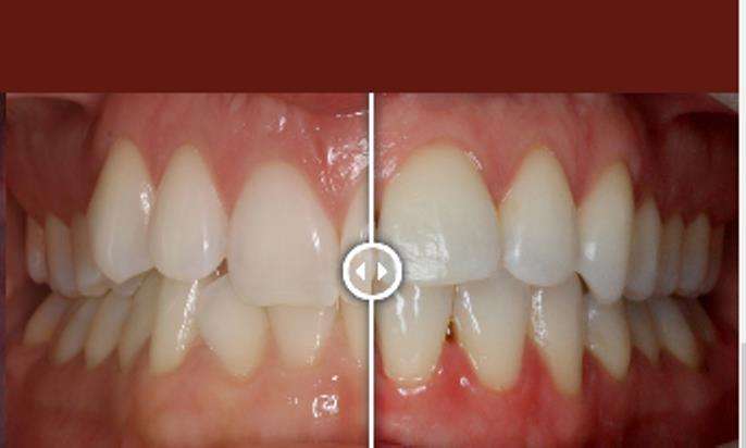 Alamo Ranch Orthodontics | 5616 Lone Star Pkwy #104, San Antonio, TX 78253, USA | Phone: (210) 920-4930 Alamo Ranch Orthodontics | 5616 Lone Star Pkwy #104, San Antonio, TX 78253, USA | Phone: (210) 920-4930