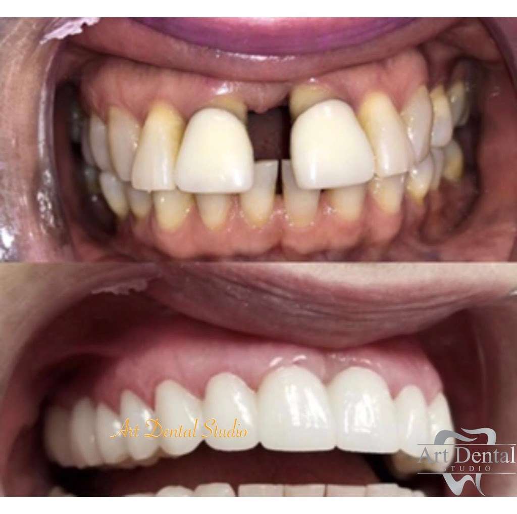 Art Dental Studio | 10026 Griffin Rd, Cooper City, FL 33328, USA | Phone: (954) 233-0707