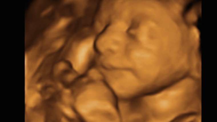 My Sweet Baby 3D/4D Ultrasounds | 5530 25th St, Columbus, IN 47203 | Phone: (812) 260-1881